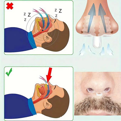 Snarkfri Näsvidgare – För bättre andning och lugnare sömn